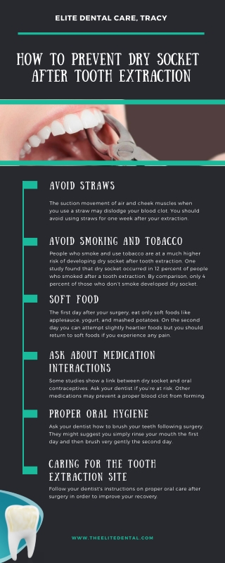 How to Prevent Dry Socket After Tooth Extraction