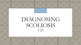 Diagnosing Scoliosis C25