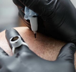 Scalp Micropigmentation (SMP) in Sacramento, CA
