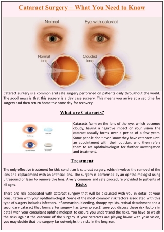 Cataract Surgery – What You Need to Know