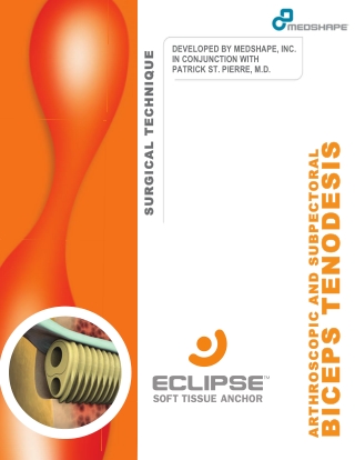 Biceps Tenodesis - Surgical Technique Guide | Eclipse™ Soft Tissue Anchor
