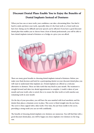 Discount Dental Plans Enable You to Enjoy the Benefits of Dental Implants Instead of Dentures