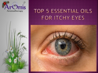 Top 5 Essential Oils for Itchy Eyes