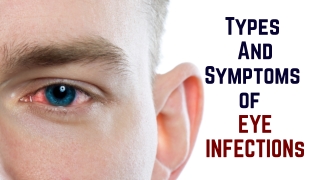Types and Symptoms of Eye Infection