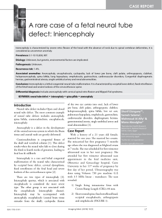 A rare case of a fetal neural tube defect: Iniencephaly