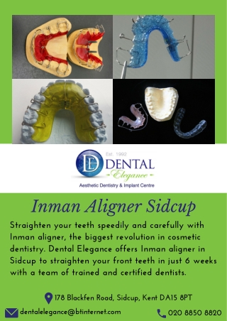 Inman Aligner Sidcup