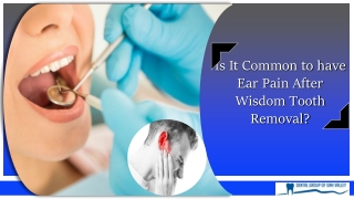 Is It Common to have Ear Pain After Wisdom Tooth Removal