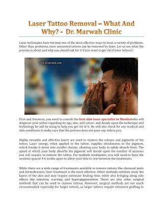 Laser Tattoo Removal – What And Why? - Dr. Marwah's Clinic