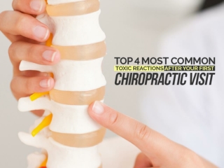 Top 4 Most Common Toxic Reactions After Your First Chiropractic Visit