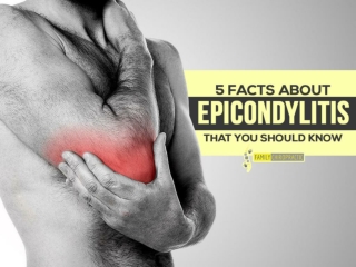 5 Facts About Epicondylitis That You Should Know