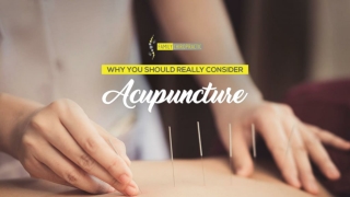 Why You Should Really Consider Acupuncture