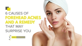 6 Causes Of Forehead Acnes And A Remedy That May Surprise You