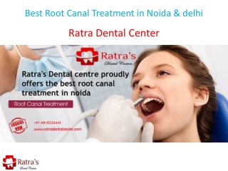 Best Root Canal Treatment in Noida & delhi
