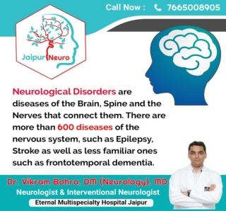 Do you have second opinion for stroke treatment in Jaipur.