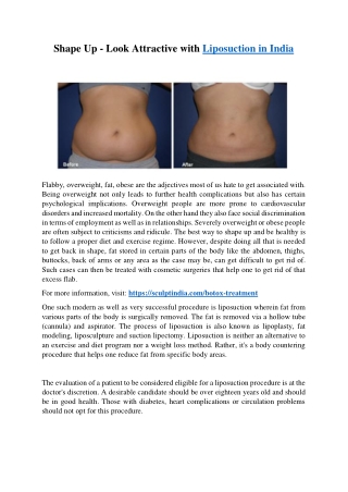 Shape Up - Look Attractive with Liposuction In India