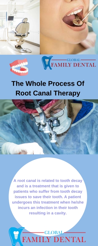 Root Canals therapy PDF | Roots canals therapy PPT