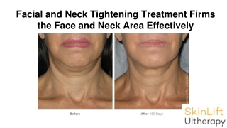 Facial and Neck Tightening Treatment Firms the Face and Neck Area Effectively