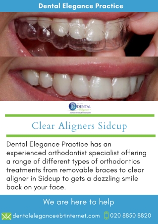 Clear Aligners Sidcup