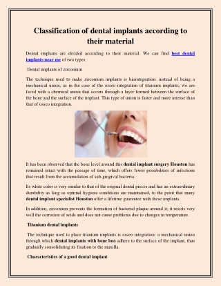 best dental implants near me