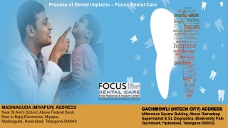 Dental Tourism in Hyderabad | Dental Services for International Patients