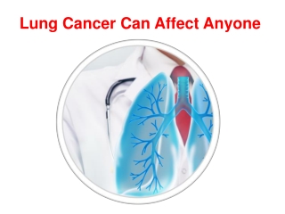 Lung Cancer can affect Anyone