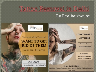 Tattoo Removal in Paschim vihar