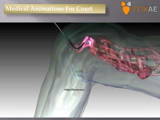 Medical Animations For Court
