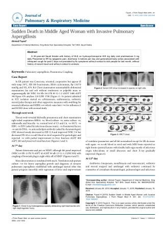 Sudden Death in Middle Aged Woman with Invasive Pulmonary Aspergillosis