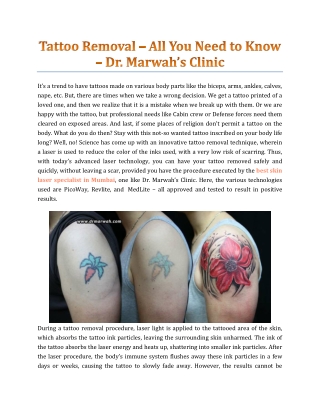 Tattoo Removal – All You Need To Know - Dr. Marwah Clinic