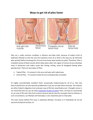 Ways to get rid of piles faster