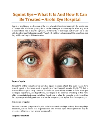 Squint Eye – What It Is And How It Can Be Treated - Arohi Eye Hospital
