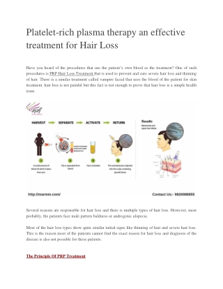 Platelet-rich plasma therapy an effective treatment for Hair Loss