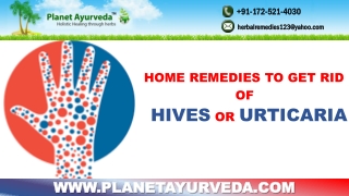 Home Remedies to Get Rid of Hives or Urticaria