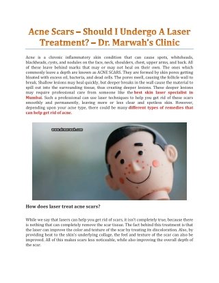 Acne Scars – Should I Undergo A Laser Treatment? - Dr. Marwah ClinicAcne scars are of various types, but they could be v