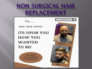 Non Surgical Hair Replacement