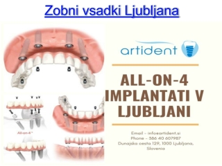 Zobni vsadki Ljubljana