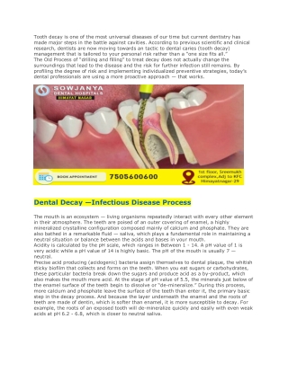 How To Assess Your Teeth Decay Risk