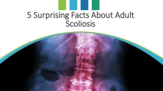 5 Surprising Facts About Adult Scoliosis