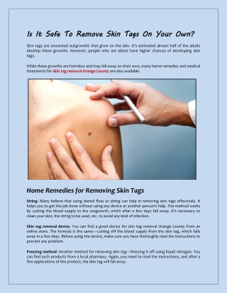 Is It Safe To Remove Skin Tags On Your Own?