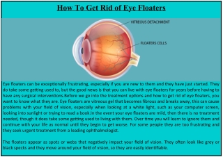 How To Get Rid of Eye Floaters