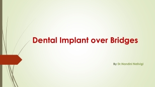 Dental Implant Over Bridges