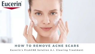 How to remove acne scars-acne treatment malaysia