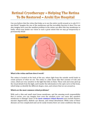 Retinal Cryotherapy – Helping The Retina To Be Restored - Arohi Eye Hospital