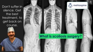 What is Scoliosis Surgery | Dr Jwalant Mehta