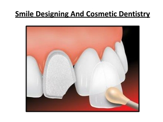 Smile Designing and Cosmetic Dentistry