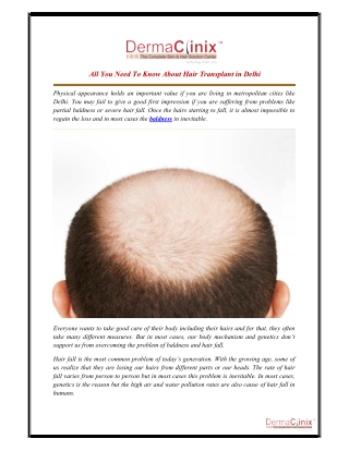 All You Need To Know About Hair Transplant in Delhi