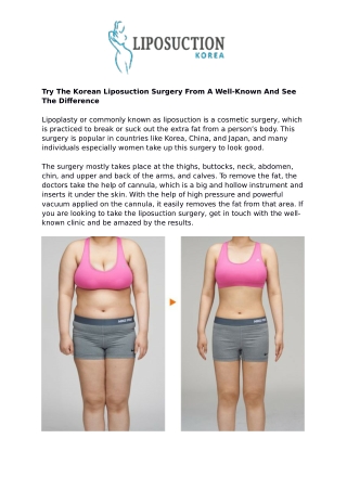 Try The Korean Liposuction Surgery From A Well-Known And See The Difference