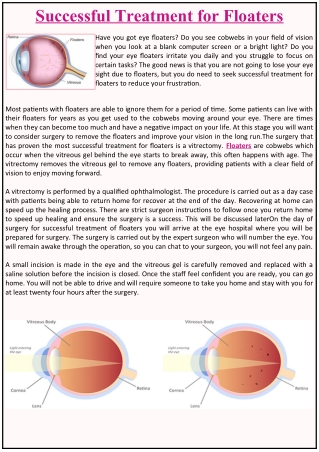 Successful Treatment for Floaters