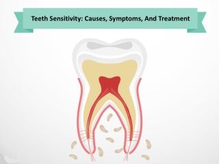 Teeth Sensitivity: Causes, Symptoms, And Treatment