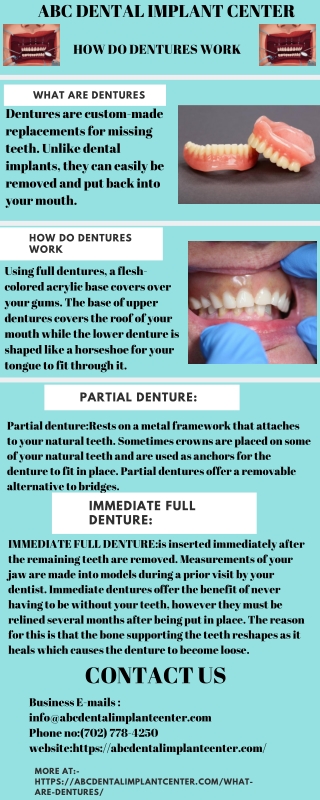 What are dentures?